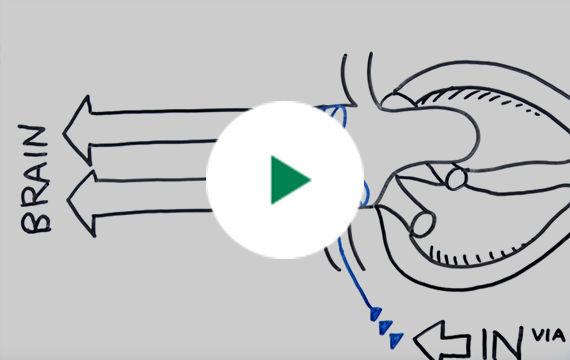 Why is Protected TAVR important?