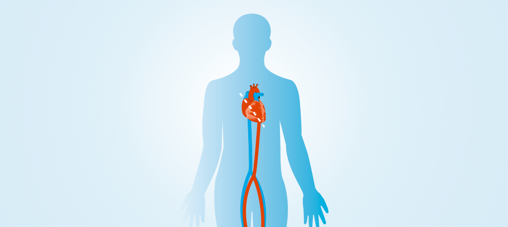 Surgical Aortic Valve Replacement (SAVR)