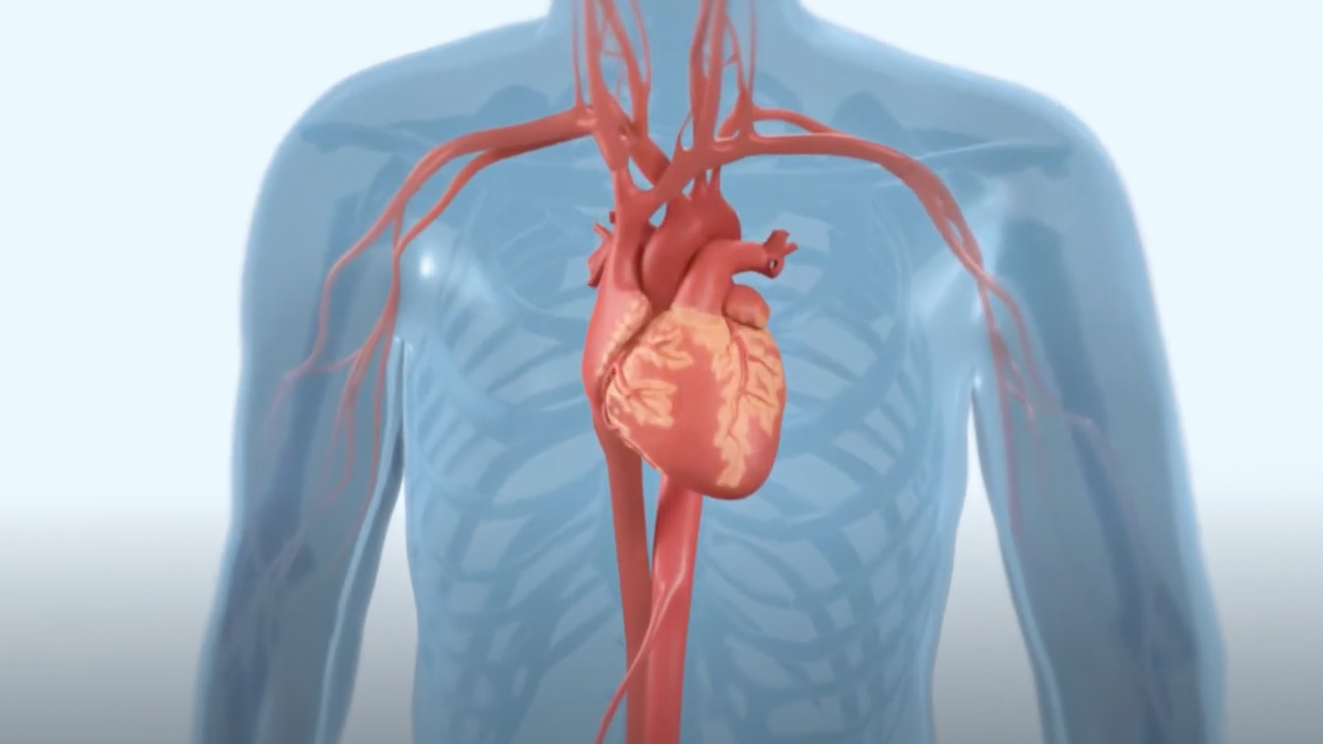 Severe aortic stenosis and your treatment options